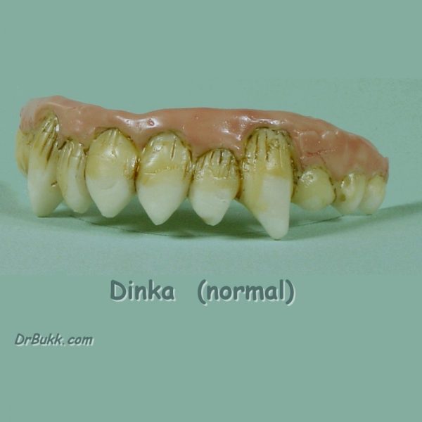 Dinka Teeth