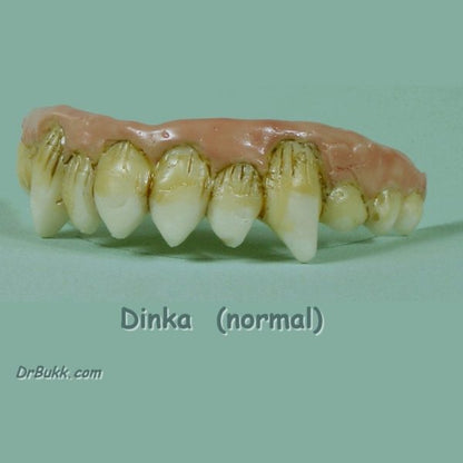 Dinka Teeth