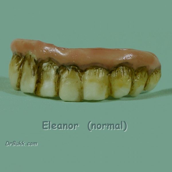 Eleanor Teeth