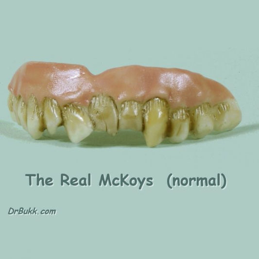 The Real McKoys Teeth